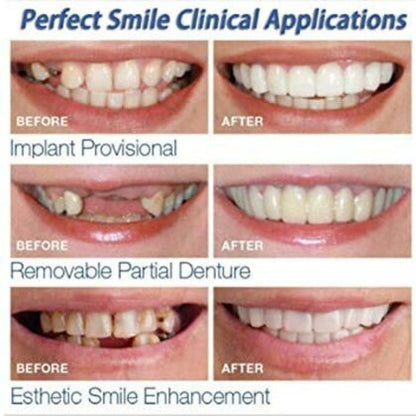 Snap In Teeth For Men & Women